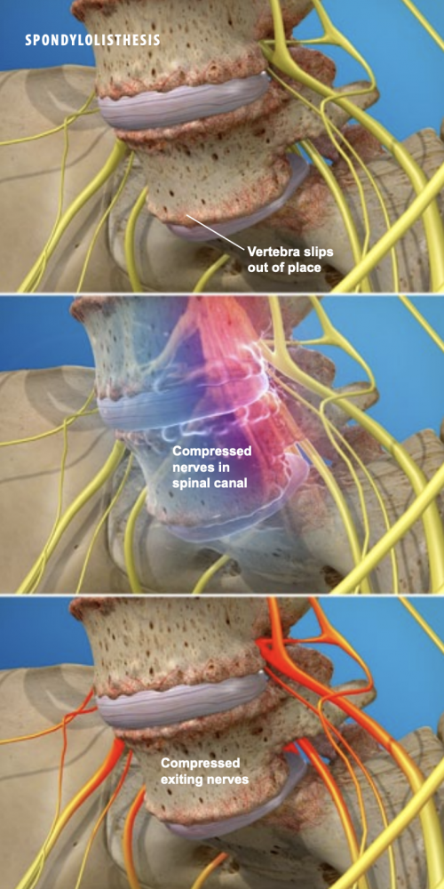 Pain Diagnosis NJ | Need to Find the Cause of Your Pain