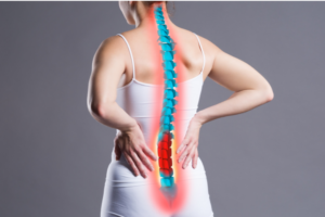 Sciatica lower back pain 